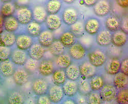 Attēlu rezultāti vaicājumam “Lycogala cf. fossiculatum sessile”