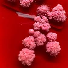 Attēlu rezultāti vaicājumam “Trichia alpina young”