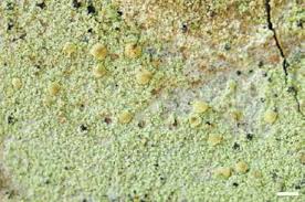 Attēlu rezultāti vaicājumam “Octospora splachnophila”