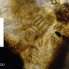 Attēlu rezultāti vaicājumam “Alyxoria varia”