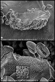 Attēlu rezultāti vaicājumam “Licea minima spores”
