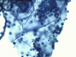 Attēlu rezultāti vaicājumam “Heterotrichia obvelata (syn. Arcyria obvelata) spores”