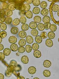 Attēlu rezultāti vaicājumam “Trichia erecta macro”