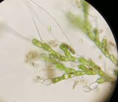 Attēlu rezultāti vaicājumam “Bulbochaete mirabilis”