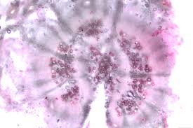 Attēlu rezultāti vaicājumam “Diderma radiatum stalked”