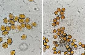 Attēlu rezultāti vaicājumam “Stemonaria irregularis spores”