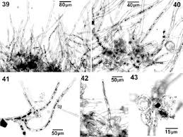 Attēlu rezultāti vaicājumam “Trentepohlia sp.”