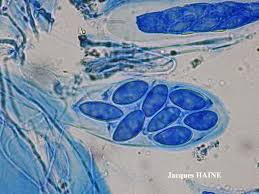 Attēlu rezultāti vaicājumam “Porpidia macrocarpa”