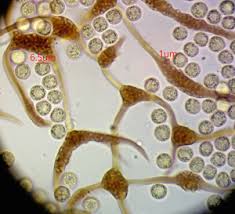 Attēlu rezultāti vaicājumam “Cribraria aurantiaca stalked”