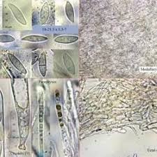 Attēlu rezultāti vaicājumam “Cudoniella acicularis”