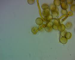 Attēlu rezultāti vaicājumam “Trichia contorta”