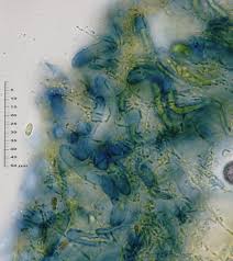 Attēlu rezultāti vaicājumam “Trapeliopsis flexuosa”