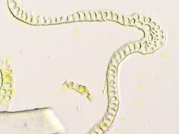 Attēlu rezultāti vaicājumam “Grimmia muehlenbeckii”