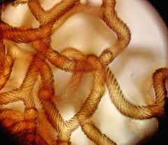 Attēlu rezultāti vaicājumam “Lycogala ustulatum sessile”