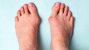 Znalezione obrazy dla zapytania palec