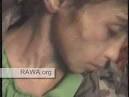 7 year old girl - victim of