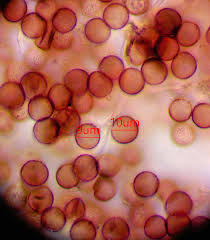 Attēlu rezultāti vaicājumam “Physarum orbis”
