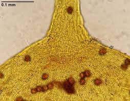 Attēlu rezultāti vaicājumam “Dicranella staphylina cells”
