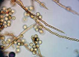 Attēlu rezultāti vaicājumam “Lycogala fuscoolearium macro”