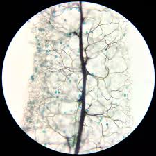 Attēlu rezultāti vaicājumam “Stemonitopsis gracilis”