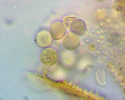 Attēlu rezultāti vaicājumam “Trichiaceae, Hemitrichiaceae, Arcyriaceae”