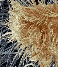 Attēlu rezultāti vaicājumam “Anthrenus sp. larva”