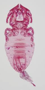 Attēlu rezultāti vaicājumam “Licea pusilla macro”