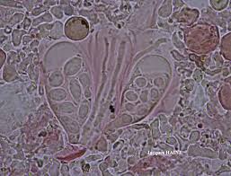 Attēlu rezultāti vaicājumam “Lecanora conizaeoides”