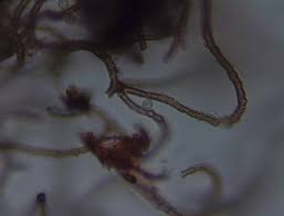 Attēlu rezultāti vaicājumam “Heterotrichia oerstedii (syn. Arcyria oerstedii) sessile”