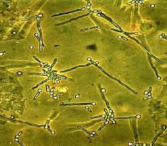 Attēlu rezultāti vaicājumam “Badhamia affinis spores”