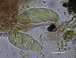 Attēlu rezultāti vaicājumam “Verrucaria hydrela”