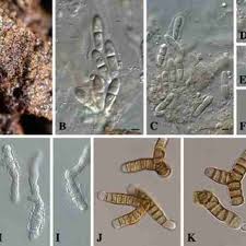 Attēlu rezultāti vaicājumam “Mycosphaerella ulmi”