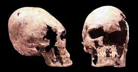 Image result for elongated skulls