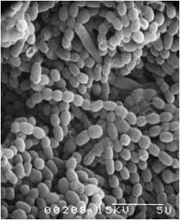 Attēlu rezultāti vaicājumam “Sarcoporia polyspora”