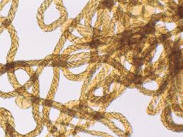 Attēlu rezultāti vaicājumam “Metatrichia floriformis spores”