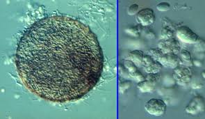 Attēlu rezultāti vaicājumam “Barbeyella minutissima spores”