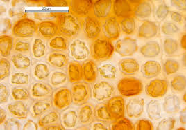 Attēlu rezultāti vaicājumam “Odontoschisma denudatum cells”