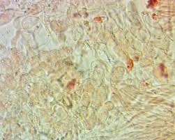 Attēlu rezultāti vaicājumam “Orbilia sp.”