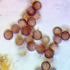 Attēlu rezultāti vaicājumam “Lycogala fuscoolearium sessile”