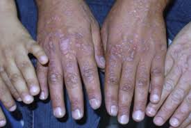 Image result for Lewandowsky-Lutz