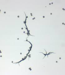 Attēlu rezultāti vaicājumam “Lamproderma violaceum spores”