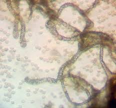 Attēlu rezultāti vaicājumam “Lycogala sphaeroconicum sessile”