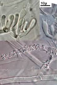 Attēlu rezultāti vaicājumam “Athelia arachnoidea”