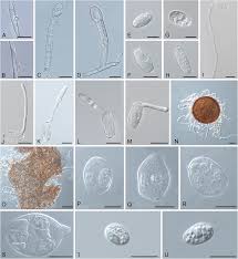 Attēlu rezultāti vaicājumam “Erysiphe galeopsidis”