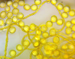 Attēlu rezultāti vaicājumam “Perichaena sp.”