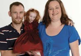 Image result for Nanismo Primordial