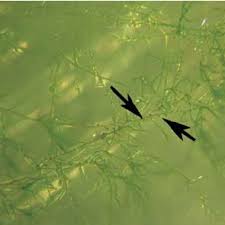 Attēlu rezultāti vaicājumam “Dicranum polysetum sporophyte”