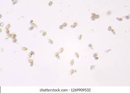 Attēlu rezultāti vaicājumam “Pucciniastrum areolatum”