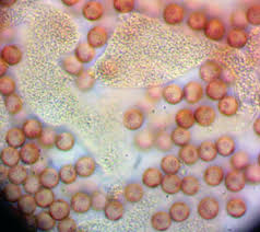 Attēlu rezultāti vaicājumam “Physarum bryomacrocarpum macro”