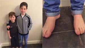 Image result for Amazing Feet Rc, Kidderminster